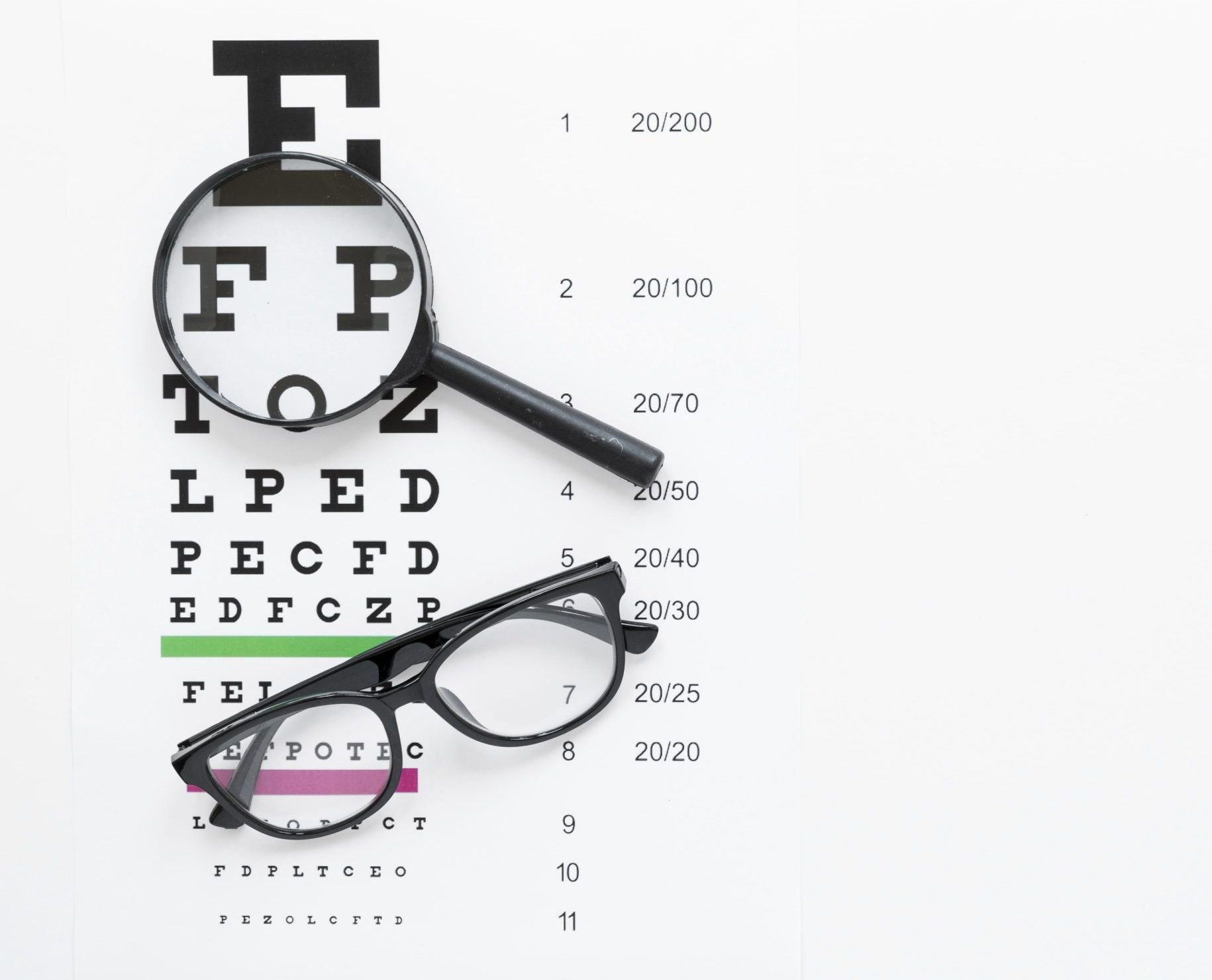 Panduan Gejala Mata: Mata Minus Adalah Penyebab, Gejala, dan Cara Mengatasinya