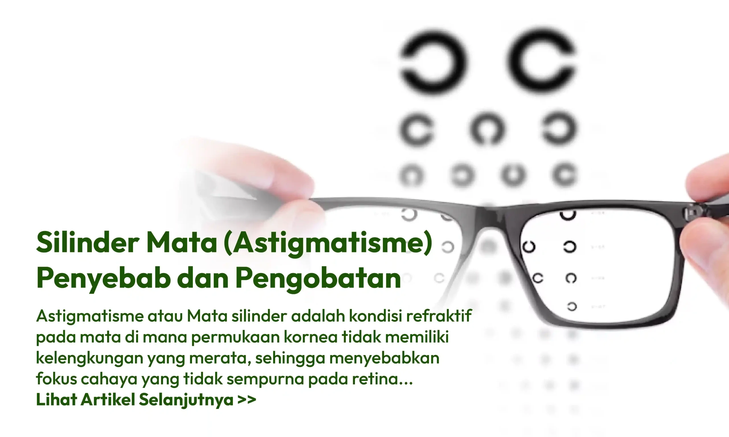 Mata Silinder (Astigmatisme) Gejala, Penyebab, dan Solusinya